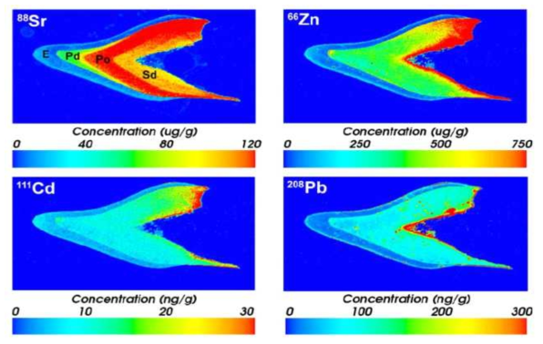 LA-ICP MS 원소 이미징을 통한 치아상 금속의 분포