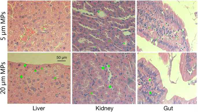 마우스의 간과 신장, 내장에 축적된 5um, 20um의 미세플라스틱 예시 (출처: scientific repots, 2017)