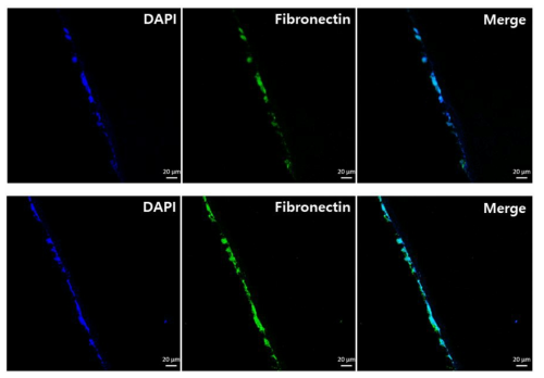 나노섬유막 위에서 배양한 fibroblast의 면역조직화학적 염색