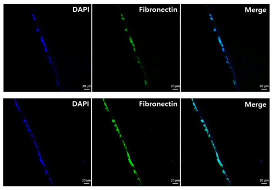 나노섬유막 위에서 배양한 fibroblast (표현형이 2주간 유지)