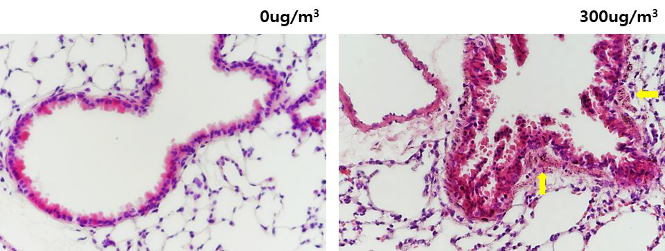고농도(300μg/m3) 미세먼지 노출 마우스에서의 조직병리학적 양상