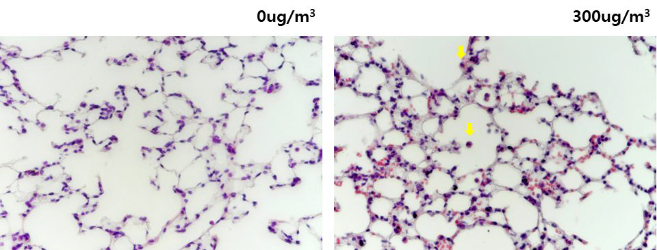 고농도(300μg/m3) 미세먼지 노출 마우스에서의 Road dust를 포함하는 macrophage 관찰