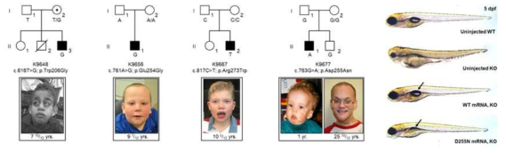 X 염색체 연관 지적장애 및 뇌발달장애 Armfield Syndrome 원인 유전자 FAM50A 연구