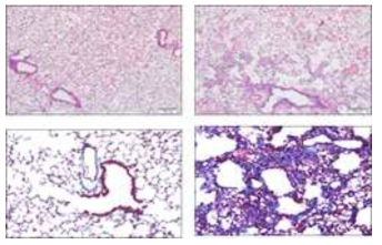 시험물질 투여 후 폐 조직 H&E(상) 및 MT(하) 염색
