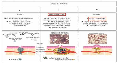 폐섬유화의 발병에 관한 창상치유모델