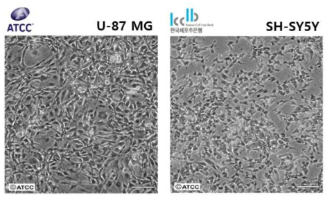 U-87 MG와 SH-SY5Y 세포의 형태