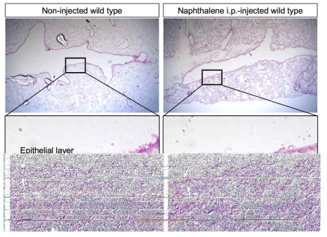 Naphthalene 복강내 주입 3일후 폐조직의 비교조직학적 분석