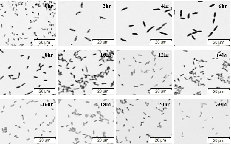 CO1 균주의 cell morphology