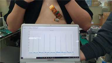 패치 소자와 결합된 플렉서블 모듈로 측정한 ECG 파형