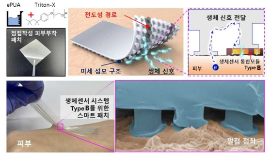 생체센서 시스템 Type B를 위한 스마트 패치의 점착성 향상과 피부에 부착된 스마트 패치의 생체 신호 전달 모식도 및 주사전자현미경 이미지