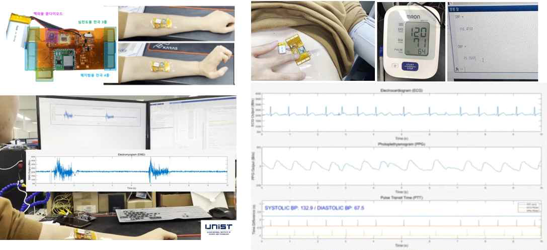 플렉서블 생체센서 신호처리/통신 통합모듈 및 근전도, 심전도, 상대혈압 시제품 측정 결과