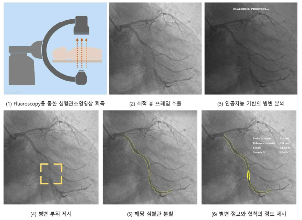 개발기술의 개념도