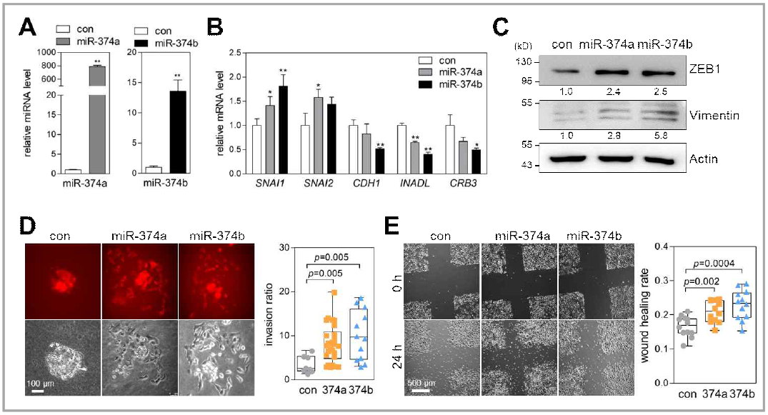 miR-374a/b에 의한 폐암세포의 EMT, 침윤, 이동 활성 증가