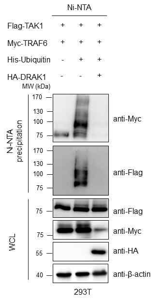 DRAK1 발현에 따른 TRAF6 매개 TAK1 유비퀴틴화 분석