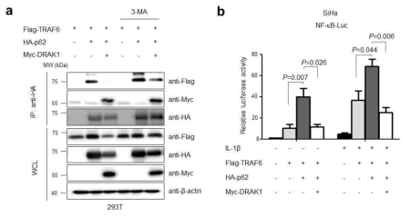 TRAF6 단백질의 안정화에 관여하는 p62 단백질과 DRAK1과의 상호작용 분석