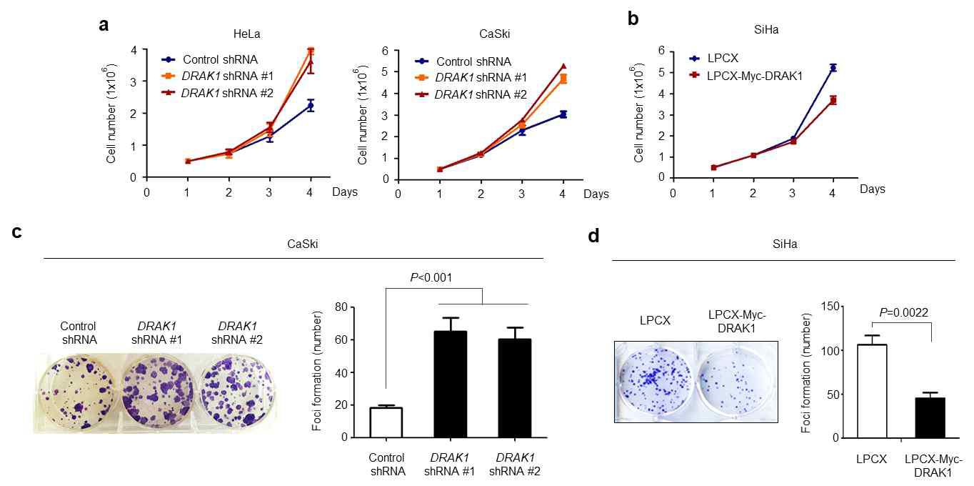 DRAK1 발현 차이에 따른 세포 성장 및 foci formation 분석