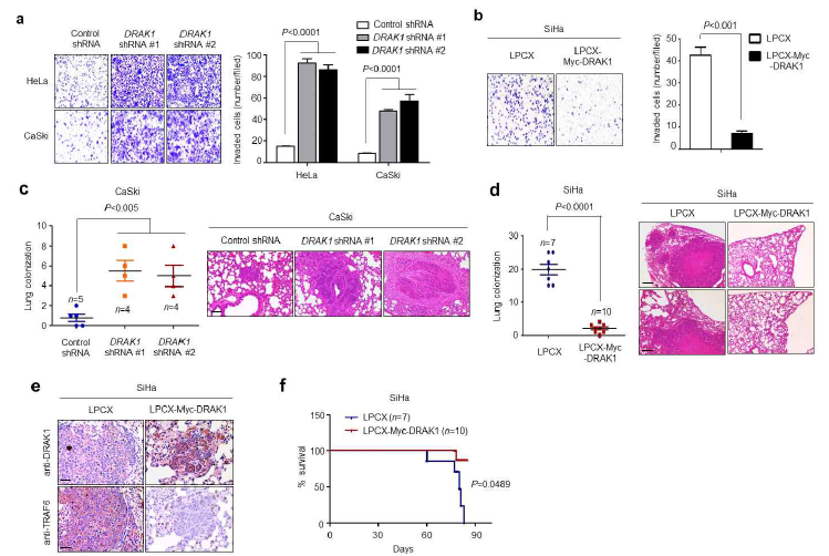 DRAK1 단백질 발현에 의한 자궁경부암 세포주의 생체내 (in vivo) 전이 능력 분석