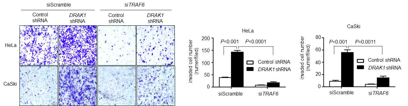 TRAF6 knockdown시 DRAK1 knockdown에 의해 증가된 세포침습능력 변화 분석