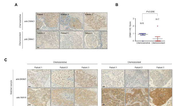 자궁경부암 환자 TMA 조직에서 DRAK1 및 TRAF6 단백질 발현 분석