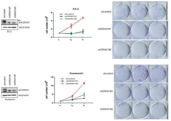 DRAK1 발현 억제시 난소암 세포 성장과 병용 형성 억제 결과 분석