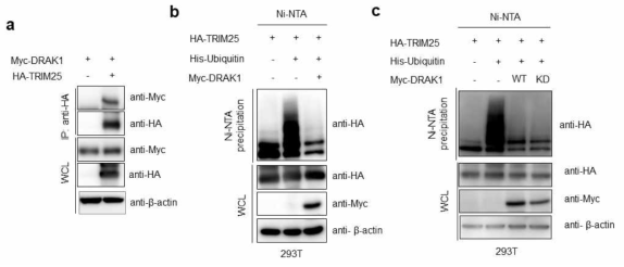 DRAK1과 TRIM25 단백질간의 상호결합 및 TRIM25 유비퀴틴화 분석