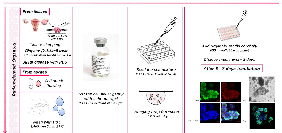 환자 조직 및 복수 유래 난소암 오가노이드 구축 방법