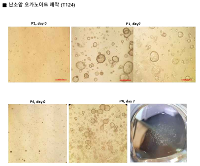 환자 조직 유래 난소암 오가노이드의 계대 배양