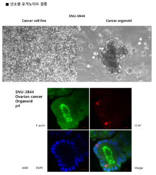 난소암 환자 조직 유래 오가노이드 검증