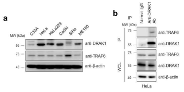 여러 가지 자궁경부암 세포주에서 DRAK1 단백질과 TRAF6 단백질 발현 분석