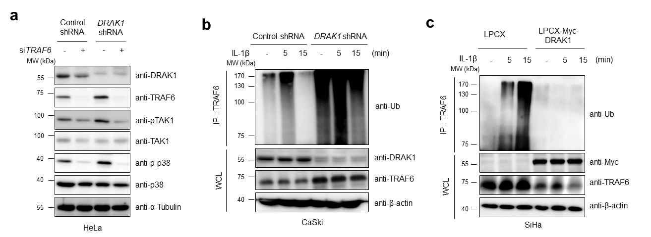 DRAK1 발현에 따른 IL-1β 유도 TRAF6 auto-ubiquitination 분석