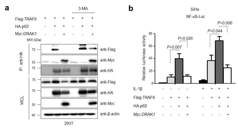 TRAF6 단백질의 안정화에 관여하는 p62 단백질과 DRAK1과의 상호작용 분석