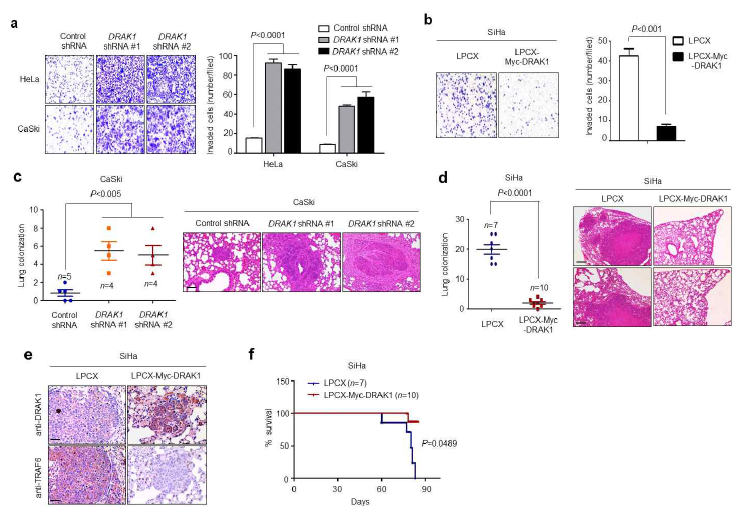 DRAK1 단백질 발현에 의한 자궁경부암 세포주의 생체내 (in vivo) 전이 능력 분석