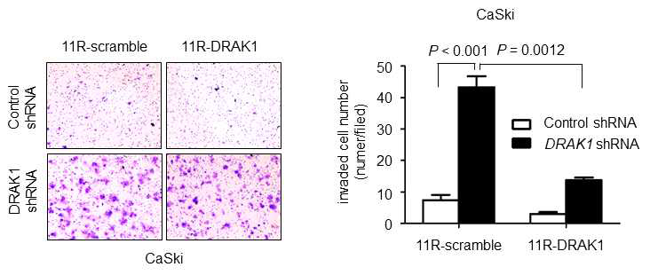 DRAK1 knockdown에 의해 증가된 세포침습 능력에서 DRAK1 펩타이드 효과 분석