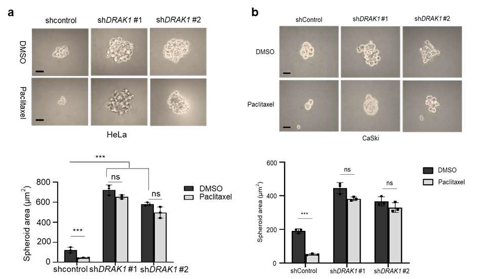 DRAK1 knockdown에 의한 paclitaxel 민감도를 3D organoid culture로 분석