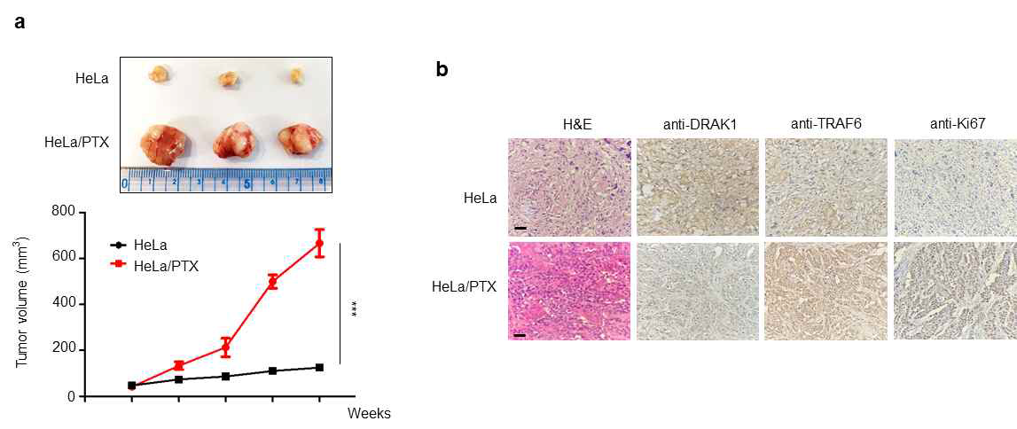 HeLa/PTX 세포주에 의한 종양 형성 향상과 면역염색 결과 분석