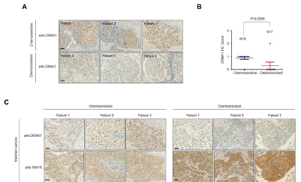 자궁경부암 환자 TMA 조직에서 DRAK1 및 TRAF6 단백질 발현 분석