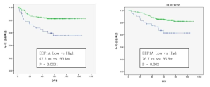 EEF1A1 단백발현에 따른 대장암 환자의 예후 예측