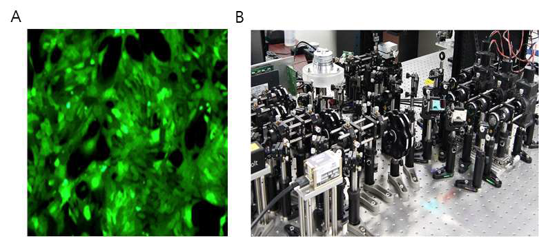 metastasis model의 관찰 (A) 4T1-GFP cells (B) Lab built confocal microscopy