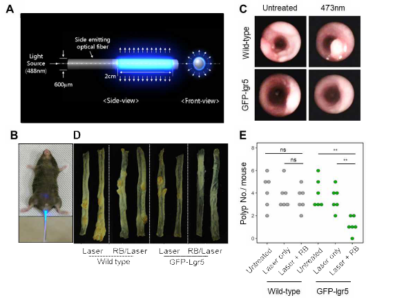 Lgr5+ 세포에 대한 광역학 치료법의 치료 효과 (A) 마우스 대장 상피에 균일한 빛을 전달하기 위한 원통형 확산 섬유 (Cylindrical diffuse fibers) (B) 확산 섬유를 사용한 마우스 대장의 빛의 조사 (irradiation) (C) Coloview system을 사용하여 얻은 wild-type (상단 이미지) 및 GFP-LGR5 (하단 이미지) 마우스 모델의 대장에 대한 in-vivo bright-field (D) 실험 후 분리된 대장의 이미지 (E) 다양한 조건의 광역학 처리하에서 대장 용종 수의 측정 (ns, not significant, **, P < 0.01)