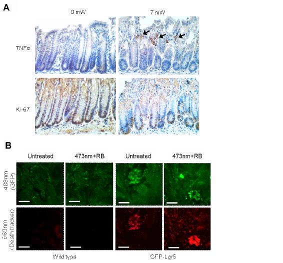 파장 기반의 심부조직 손상 (A) 조사 전후의 TNFα와 Ki-67 staining (B) 로즈 벵갈 (RB) 투여 및 레이저 조사 후 주변 eGFP+ 영역에서의 특정 사멸 시그널 (스케일 바: 100 μm)