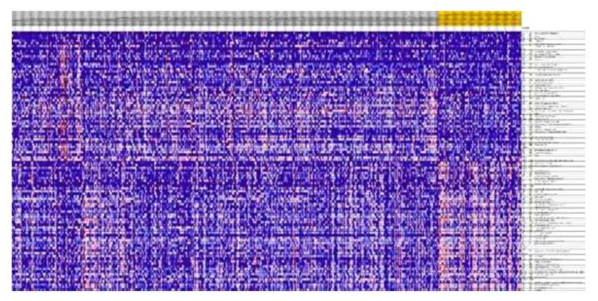 479명의 신장암 환자의 M0 RCC와 M1 RCC의 Heat map 분석 결과