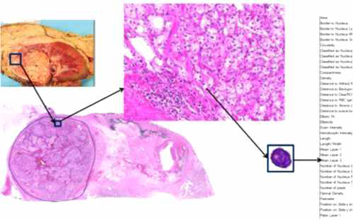 디지털 병리분석의 예시