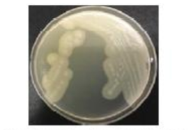 난황 첨가 TSC 한천배지에서의 Clostridium perfringens 군락