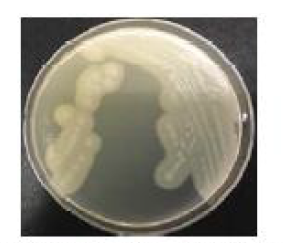 난황 첨가 TSC 한천배지에서의 Clostridium perfringens 군락