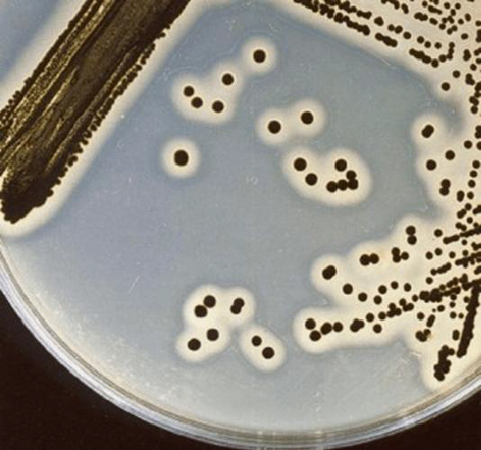 Egg Yolk for MSA에서의 Staphylococcus aureus 군락