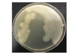 난황 첨가 TSC 한천배지에서의 Clostridium perfringens 군락