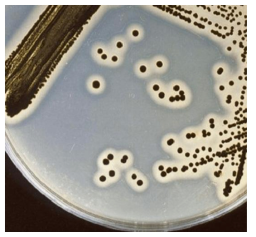 Egg Yolk for MSA에서의 Staphylococcus aureus 군락