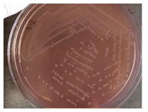 MacConkey 배지에서의 Shigella spp.의 군락