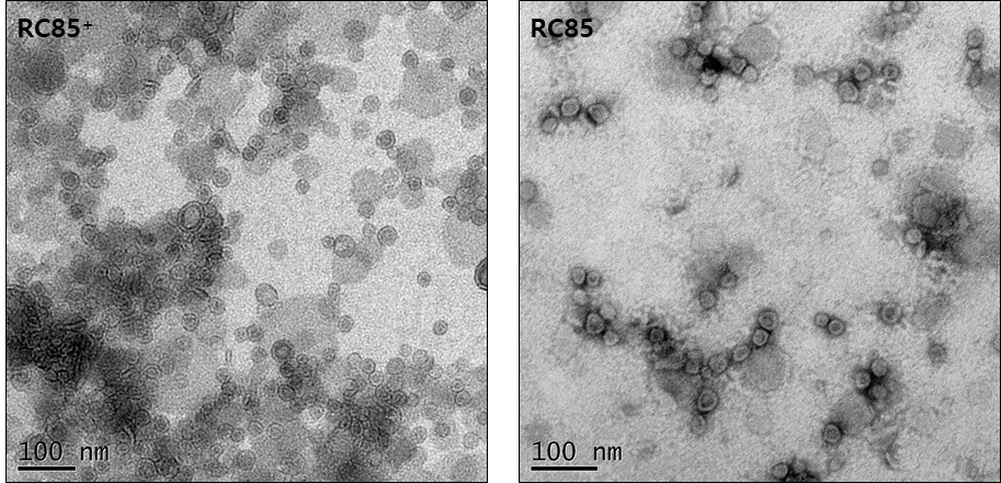 Picture of OMVs from RC85+ or RC85 using transmission electron microscopy