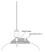 Guide cannula 고정을 위한 덴탈 시멘트 처리 예시